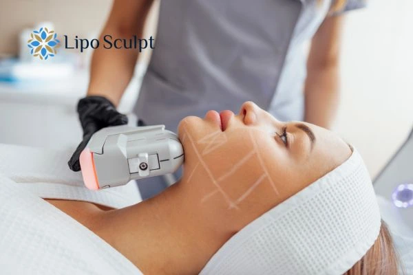 HIFU vs Botox Stratford upon Avon What is the best option for you?