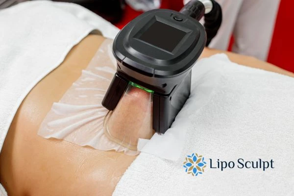 Does Fat Freezing at Home Work? DIY Devices vs Professional Cryolipolysis 1 How is professional cryolipolysis different Stratford upon Avon?