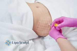 Are The Results From Aqualyx Permanent? 1 Do you want to know how long Aqualyx Stratford upon Avon results last?