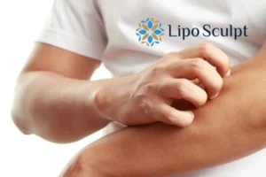 prevent your actinic keratoses Stratford upon Avon getting worse - call our team today!