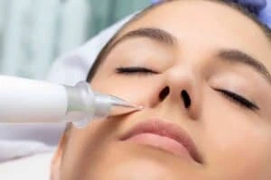 Actinic keratoses Stratford upon Avon solutions - book in today!