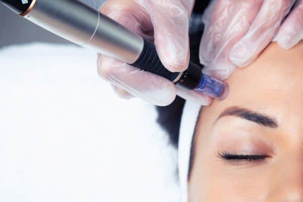 Explaining Total Skin Tightening Treatment and What to Expect 2 What Skin Concerns Can Total Skin Tightening Treatment Help With Stratford upon Avon?