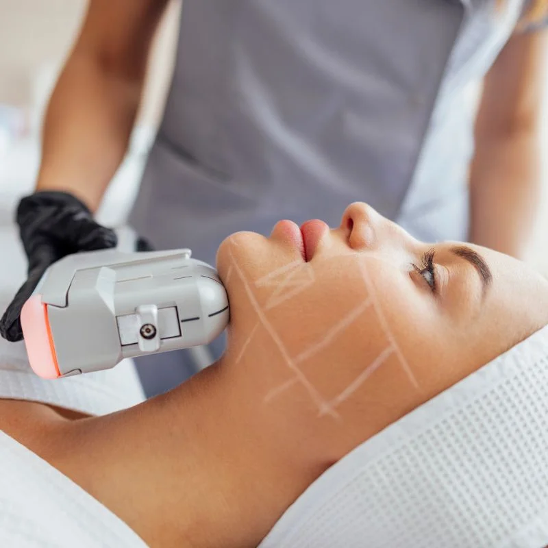 HIFU non surgical treatment Stratford upon Avon